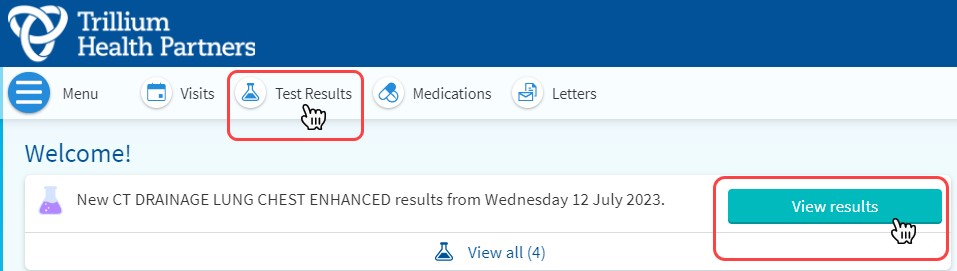 View results button